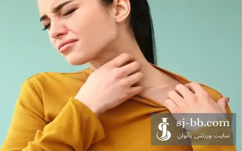 خارش بدن