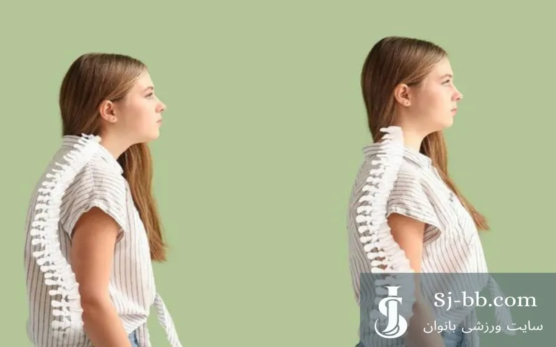 حرکات اصلاحی