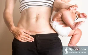 ورزش بعد از سزارین